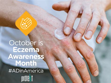 October Is National Eczema Awareness Month. Skin Care Tips You Can Use